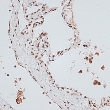 ZNF148 Antibody