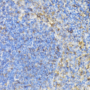 ZNF148 Antibody