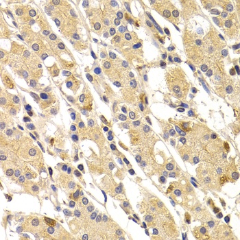 TNNI3 Antibody