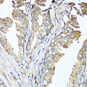 STK3 Antibody