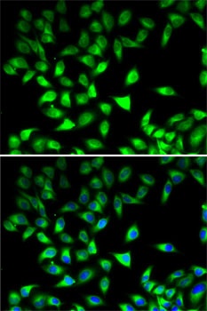 STAT4 Antibody