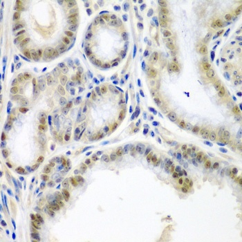SSX2 Antibody