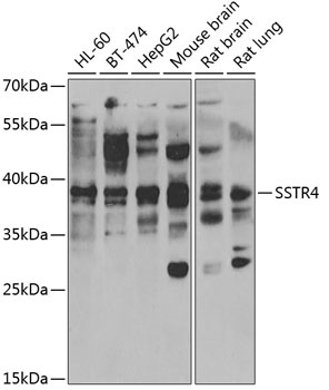 SSTR4 Antibody
