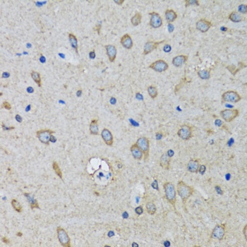 SSBP1 Antibody