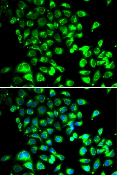 SSBP1 Antibody