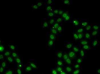 SSBP1 Antibody