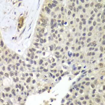 SNRPD2 Antibody