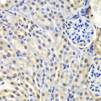 SNRPD2 Antibody