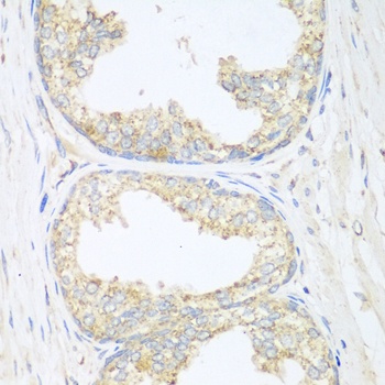 SGCB Antibody