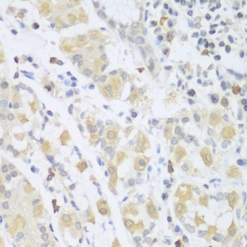 SGCB Antibody