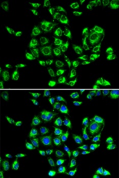 RPS16 Antibody