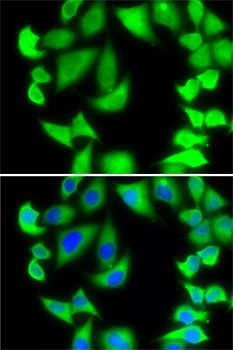 RPS5 Antibody