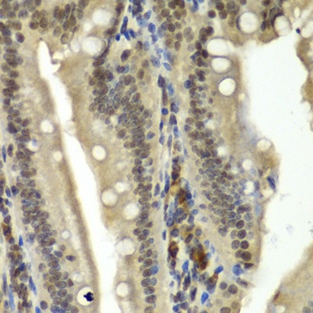 RBBP5 Antibody