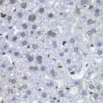 RBBP5 Antibody