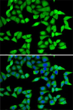 RBBP5 Antibody