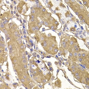 RASGRF1 Antibody