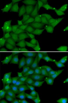 RASGRF1 Antibody