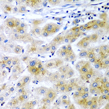 RARRES2 Antibody