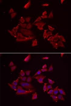 RARRES2 Antibody