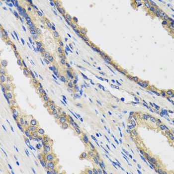 RAD51C Antibody