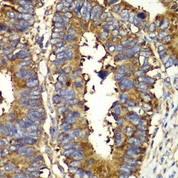 QARS Antibody