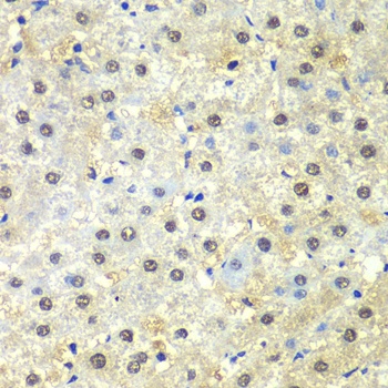 PSMD13 Antibody