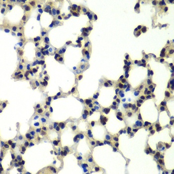 PSMD13 Antibody