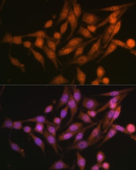 PSMD13 Antibody