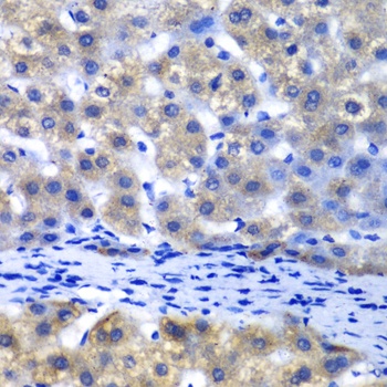 PSMD8 Antibody