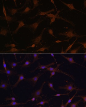 PRKAB2 Antibody