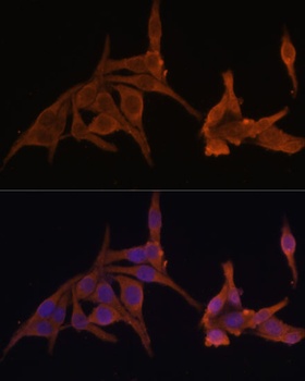 PRKAB2 Antibody