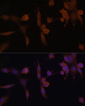 PRKAB2 Antibody