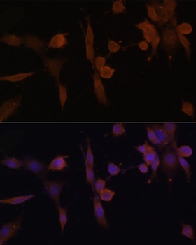 PRKAB2 Antibody