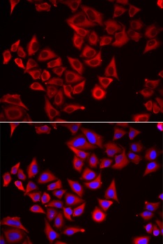 SRGN Antibody