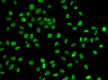 PMS2 Antibody