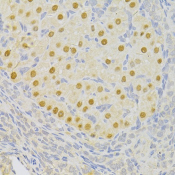 PFKFB3 Antibody