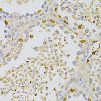 PFKFB3 Antibody