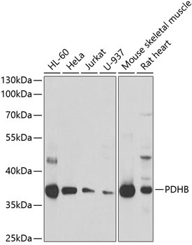 PDHB Antibody