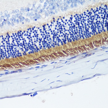 PDE6B Antibody