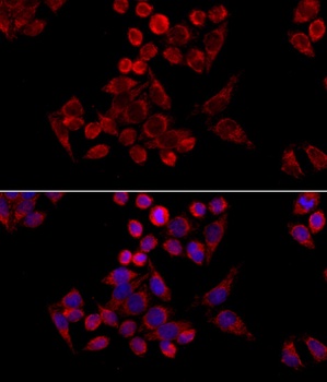 NASP Antibody