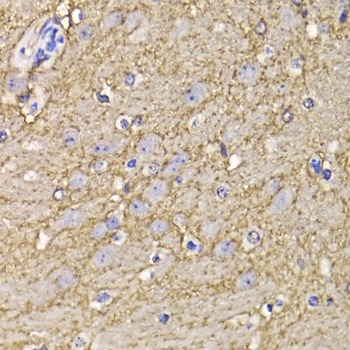 KCND3 Antibody