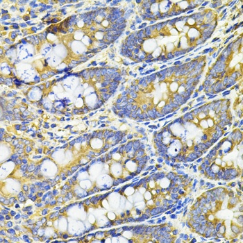 HPGD Antibody