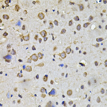 HPGD Antibody
