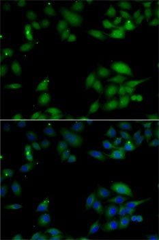 HIP1 Antibody