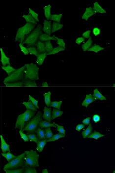 HABP2 Antibody