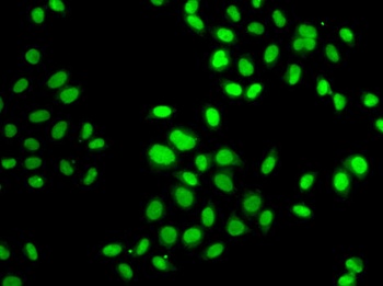 GPS1 Antibody