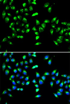 GALNT2 Antibody