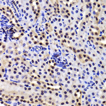 GABPB1 Antibody