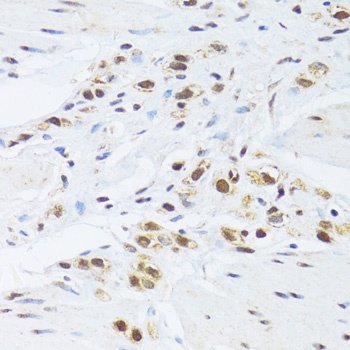 GABPB1 Antibody