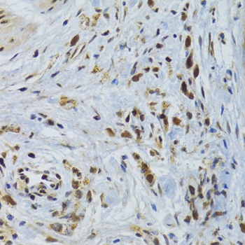 GABPB1 Antibody